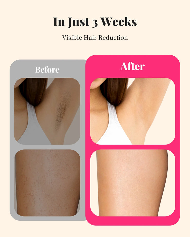 SmoothSilk Laser Hair Remover