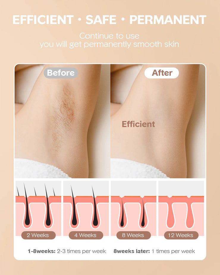 SmoothSkin Laser Hair Remover